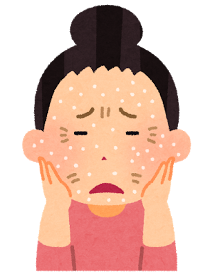 乾燥肌の対策にスキンケアは?食事や生活で気を付けること